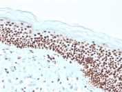 IHC staining of FFPE human skin with recombinant Nucleophosmin antibody (clone rNPM1/1901). HIER: boil tissue sections in pH 9 10mM Tris with 1mM EDTA for 20 min and allow to cool before testing.