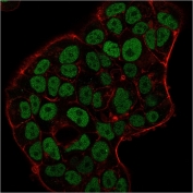 MSH6 Antibody for IF staining of PFA-fixed human MCF-7 cells. Immunofluorescence analysis shows strong nuclear green signal corresponding to MutS homolog 6 (MSH6), consistent with the nuclear localization of this DNA mismatch repair protein. Cells were stained with the mouse monoclonal MSH6 antibody clone MSH6/3091 (green), while Phalloidin (red) highlights filamentous actin outlining the cytoskeleton and cell boundaries.