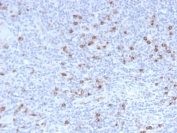 Granzyme B Antibody Human Tonsil IHC. Immunohistochemical staining of FFPE human tonsil tissue using Granzyme B Antibody. HIER was performed in pH 9 Tris-EDTA buffer. An HRP-conjugated secondary antibody with DAB substrate was used for detection. Granzyme B Antibody, a Cytotoxic Lymphocyte Marker Antibody, demonstrates strong granular cytoplasmic staining in scattered lymphocytes within the tonsillar lymphoid tissue, consistent with granzyme B expression in activated cytotoxic T lymphocytes and natural killer cells.