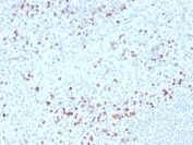 Granzyme B Antibody Biotin Conjugate Human Splenic White Pulp IHC. Immunohistochemical staining of FFPE human spleen tissue using Granzyme B Antibody Biotin Conjugate. HIER was performed in pH 9 Tris-EDTA buffer. A streptavidin-HRP detection system with DAB substrate was used for visualization. Granzyme B Antibody Biotin Conjugate, recognizing GZMB, demonstrates strong granular cytoplasmic staining in cytotoxic lymphocytes concentrated within the splenic white pulp, consistent with granzyme B expression in activated cytotoxic T lymphocytes and natural killer cells.