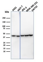Recombinant PD-L1 Antibody PDL1/4451R in Human Cancer Cell Lines WB. Western blot testing of Recombinant PD-L1 Antibody PDL1/4451R / B7-H1 in human A431, MCF-7, JEG-3, MDA-MB-231 and SW732 cell lysates. A prominent band is observed at approximately 40-45 kDa across the tested cell lines, above the predicted molecular weight of ~33 kDa for unmodified PD-L1/CD274. The higher apparent molecular weight is consistent with the established N-linked glycosylation of mature PD-L1. This Recombinant PD-L1 Antibody demonstrates detection of glycosylated B7-H1/CD274 across multiple human cancer cell lines.