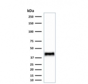 BMI1 Antibody NIH3T3 WB. Western blot analysis of mouse NIH3T3 cell lysate using BMI1 Antibody / Polycomb Stem Cell Renewal Marker. A distinct band is detected near 37-43 kDa, consistent with the predicted molecular weight range of BMI1. The observed expression pattern supports the chromatin-associated role of BMI1 in polycomb-mediated transcriptional repression, stem cell self-renewal signaling, and epigenetic regulation pathways involved in proliferative cell maintenance.