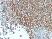 GLUT1 Antibody Recombinant Mouse MAb rGLUT1/2476. Immunohistochemistry analysis of GLUT1 / SLC2A1 in FFPE human bladder tissue demonstrates strong HRP-DAB brown membranous staining in epithelial cells consistent with the plasma membrane localization of the GLUT1 glucose transporter. The staining outlines cell borders across the epithelial layer, highlighting the characteristic membrane-associated distribution of this facilitative glucose transporter in metabolically active cells. Adjacent stromal components show minimal staining, providing contrast to the epithelial signal. Heat induced epitope retrieval was performed by boiling tissue sections in pH 9 10mM Tris buffer with 1mM EDTA for 20 minutes followed by cooling prior to antibody incubation.