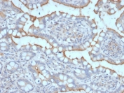 STARD1 Antibody (clone STAR/2077). Immunohistochemistry analysis of Steroidogenic Acute Regulatory Protein (StAR / STARD1) in FFPE human stomach tissue using a mouse monoclonal antibody. HRP-DAB brown cytoplasmic staining is observed in scattered epithelial and glandular cells, while most surrounding gastric mucosal cells show minimal staining. The staining pattern is consistent with localized expression of Steroidogenic Acute Regulatory Protein in specific gastric cell populations. Heat-induced epitope retrieval was performed by boiling tissue sections in pH 9 Tris-EDTA buffer (10 mM Tris with 1 mM EDTA) for 20 minutes followed by cooling prior to antibody staining.