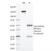 SDS-PAGE analysis of purified, BSA-free StAR/STARD1 antibody (clone STAR/2077) as confirmation of integrity and purity.