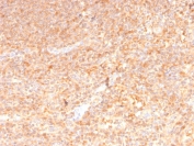 GM-CSF Antibody Human Spleen Immunohistochemistry. IHC staining of FFPE human spleen with GM-CSF antibody (clone CSF2/3402). HIER: boil tissue sections in pH 9 10mM Tris with 1mM EDTA for 10-20 min and allow to cool before testing.