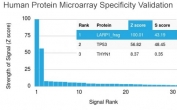 p53 Antibody Clone PAb240 / TP53 Mutant Tumor Suppressor Antibody (clone PAb240). Protein microarray specificity validation using a HuProt(TM) human protein array containing more than 19,000 full-length human proteins demonstrates selective binding of p53 Antibody Clone PAb240. The ranked signal plot shows strong signal for TP53 among the top targets detected on the array, supporting the specificity of clone PAb240 for Tumor protein p53.<BR>The Z-score represents the strength of antibody binding to each protein target detected using a fluorescently labeled secondary antibody. Z-scores are expressed in standard deviations above the mean signal across the array. Proteins are ranked by descending Z-score, and the S-score represents the difference between adjacent Z-scores in the ranked list. A high S-score indicates strong specificity of the antibody for its intended target relative to other proteins present on the array.