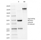 SDS-PAGE analysis of purified, BSA-free p53 Antibody Clone PAb240 / TP53 Mutant Tumor Suppressor Antibody as confirmation of integrity and purity.