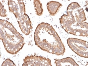 Villin Antibody. Immunohistochemistry analysis of Villin-1 (VIL1) in FFPE human small intestine using Villin Antibody / Intestinal Differentiation Marker Antibody with mouse monoclonal clones VIL1/1314 and VIL1/2376. Strong HRP-DAB brown staining is observed in mature enterocytes lining the villi, with prominent apical and luminal membrane accentuation consistent with a differentiated epithelial phenotype. The uniform staining pattern highlights fully developed intestinal epithelial architecture and supports Villin as a robust marker of enterocyte differentiation and epithelial maturation in normal small intestine tissue.