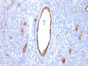 vWF Antibody / Vascular Permeability Marker Antibody. Immunohistochemistry analysis of human tonsil tissue shows HRP-DAB brown staining of endothelial cells outlining vascular channels within lymphoid tissue. The staining highlights continuous vessel linings with localized variation in signal intensity along the endothelial surface, consistent with differences in endothelial activation state and barrier function. Vessel-associated signal is clearly distinguished from surrounding lymphoid cells, enabling visualization of vascular compartments and assessment of endothelial integrity within the tissue. Clone VWF/2480 enables evaluation of vascular structure together with permeability-associated endothelial response. HIER: boil tissue sections in pH 9 10mM Tris with 1mM EDTA for 20 min and allow to cool before testing.