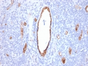 vWF Antibody / Vascular Remodeling Marker Antibody. Immunohistochemistry analysis of human tonsil tissue shows HRP-DAB brown staining of endothelial cells outlining vascular channels with variable diameter and morphology within lymphoid tissue. The staining highlights both larger, well-formed vessels and smaller branching structures, reflecting heterogeneity in vessel size and organization. Endothelial-lined channels display differences in shape and thickness, consistent with structural variation associated with vascular remodeling. Clone rVWF/2480 enables visualization of vessel architecture and morphological variation across the tissue. HIER: boil tissue sections in pH 9 10mM Tris with 1mM EDTA for 20 min and allow to cool before testing.