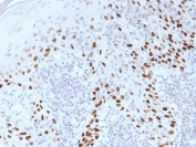 p40 Antibody. Immunohistochemistry analysis of FFPE human cervix tissue demonstrates strong HRP-DAB brown nuclear staining in basal and parabasal epithelial cells, with progressively reduced staining in more differentiated superficial layers. The nuclear-restricted pattern reflects epithelial layering and supports use of this antibody as an epithelial stratification and differentiation marker, highlighting the transition from proliferative basal compartments to differentiated cell populations. Staining is well-defined with minimal background, allowing clear visualization of epithelial organization and differentiation gradients. Heat-induced epitope retrieval was performed by boiling tissue sections in pH 9 10mM Tris with 1mM EDTA for 20 minutes followed by cooling prior to antibody incubation.