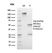 SDS-PAGE analysis of purified, BSA-free CD1A Antibody / Quantitative Specificity Validated Antibody (clone C1A/3249) as confirmation of integrity and purity.