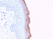 Kallikrein 5 Antibody Skin IHC. Immunohistochemistry analysis of FFPE human skin tissue stained with Kallikrein 5 Antibody demonstrates strong linear and cytoplasmic HRP-DAB brown staining within the superficial epidermal keratinocyte layers, consistent with KLK5-associated serine protease expression involved in epidermal barrier regulation and desquamation pathways. This epidermal barrier protease antibody highlights epithelial differentiation-associated signaling and cutaneous barrier homeostasis within stratified squamous epithelium. HIER: boil tissue sections in pH6, 10mM citrate buffer, for 20 min and allow to cool before testing.