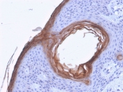 Kallikrein 5 Antibody Human Skin Tissue IHC. Immunohistochemistry analysis of FFPE human skin tissue stained with Kallikrein 5 Antibody demonstrates strong epithelial-associated HRP-DAB brown staining surrounding follicular and superficial epidermal structures, consistent with KLK5-associated serine protease expression involved in epithelial differentiation and epidermal barrier regulation. This epidermal barrier protease antibody highlights keratinocyte-associated proteolytic signaling pathways within cutaneous tissue compartments. HIER: boil tissue sections in pH6, 10mM citrate buffer, for 20 min and allow to cool before testing.