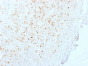 IHC staining of FFPE human tonsil with Aurora B antibody (clone AURKB/1845). HIER: boil tissue sections in pH 9 10mM Tris with 1mM EDTA for 20 min and allow to cool before testing.