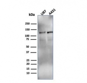 Western blot testing of human U-87 MG and A431 cell lysate with recombinant HIF1 alpha antibody (clone Ha111a).