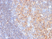 Immunohistochemistry analysis of CD19 Antibody Mouse Monoclonal in human tonsil tissue. FFPE human tonsil demonstrates strong membranous HRP-DAB brown staining in B lymphocytes within germinal centers and follicular regions, consistent with CD19 (Cluster of Differentiation 19) expression on mature B cells, while interfollicular T cell-rich areas show reduced staining. Antigen retrieval was performed by boiling tissue sections in 10mM Tris with 1mM EDTA, pH 9.0, for 10-20 minutes followed by cooling prior to incubation with CD19 antibody (clone CD19/3116).