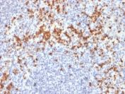 Immunohistochemistry analysis of MMP9 / Matrix metalloproteinase-9 antibody (clone SPM425) in human spleen tissue FFPE human spleen section shows cytoplasmic brown chromogenic staining in scattered immune cells consistent with MMP9 expression, while surrounding lymphoid cells display minimal staining and nuclei appear blue. Heat-induced epitope retrieval was performed by boiling tissue sections in pH 9 10 mM Tris with 1 mM EDTA for 20 minutes followed by cooling prior to staining.