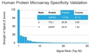 Napsin A Antibody Protein Microarray Validation. Analysis of Napsin A (NAPSA) specificity using a human protein microarray containing more than 19,000 full-length human proteins demonstrates strong and selective binding of clone NAPSA/3309 to its intended target, with NAPSA ranked as the top hit by signal intensity. The Z-score reflects the strength of binding relative to the array-wide mean signal, expressed as standard deviations above background, while the S-score represents the difference in Z-scores between the top-ranked target and the next highest protein, indicating relative specificity. The high Z- and S-scores observed for NAPSA support selective target recognition with minimal cross-reactivity across the proteome-scale panel.