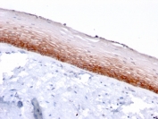 CD44v4/5 Antibody for IHC Cervical Epithelium. Immunohistochemistry analysis of CD44 variant region / CD44 expression in FFPE human cervix tissue using mouse monoclonal antibody clone 3D2. Strong membranous HRP-DAB brown staining is observed in stratified squamous epithelial cells, with signal enriched in basal and suprabasal layers and clearly outlining epithelial stratification consistent with CD44 variant-associated adhesion and epithelial organization. The staining pattern highlights normal epithelial layering and supports its use as a marker of cervical epithelial structure and differentiation. Heat induced epitope retrieval was performed by boiling tissue sections in pH 9 10mM Tris with 1mM EDTA for 20 min followed by cooling at RT before testing.
