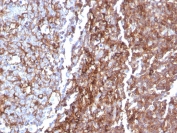 CD44 Antibody Tonsil IHC. Immunohistochemistry staining of FFPE human tonsil tissue with recombinant CD44 antibody (clone rHCAM/918). HIER: boil tissue sections in pH 9 10mM Tris with 1mM EDTA for 20 min and allow to cool before testing.