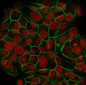 E-cadherin Antibody Clone SPM471 for IF. Immunofluorescence analysis of Cadherin 1 / CDH1 expression in human MCF7 cells using clone SPM471 antibody (green), showing strong membrane staining outlining epithelial cell borders, with Reddot nuclear stain (red). Signal highlights continuous cell-cell junctions and well-defined epithelial adhesion patterns.