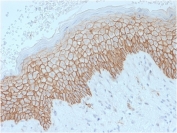 E-cadherin Antibody Clone SPM471 Human Skin IHC. Immunohistochemistry analysis of Cadherin 1 / CDH1 expression in FFPE human skin using clone SPM471 antibody, showing strong membranous HRP-DAB brown staining in stratified epithelial cells of the epidermis with clear cell-cell junction localization, while underlying dermal tissue remains largely negative. HIER: boil tissue sections in pH 9 10mM Tris with 1mM EDTA for 20 min and allow to cool before testing. Signal highlights epithelial layering and junctional organization within the epidermis.