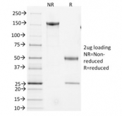CD3e Antibody Clone 145-2C11. SDS-PAGE analysis of purified, BSA-free CD3 Epsilon / CD3E antibody using CD3e Antibody Clone 145-2C11 / CD3 Epsilon Monoclonal Antibody. Two conditions are shown: NR (non-reduced) and R (reduced). Under non-reducing conditions, the antibody migrates as an intact immunoglobulin at approximately 150 kDa, while under reducing conditions distinct bands corresponding to heavy chain at approximately 50 kDa and light chain at approximately 25 kDa are observed. The clear band pattern with minimal background confirms the integrity and purity of the antibody preparation.