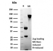 DNGR-1 Antibody SDS-PAGE Analysis. SDS-PAGE analysis of purified, BSA-free DNGR-1 Antibody / Dendritic Cell Receptor Antibody clone 1F6 demonstrates the expected antibody migration pattern under reducing (R) and non-reducing (NR) conditions. Under reducing conditions, prominent bands corresponding to the immunoglobulin heavy and light chains are observed at approximately 50 kDa and 25 kDa, respectively. Under non-reducing conditions, the antibody migrates predominantly as an intact immunoglobulin species at approximately 150 kDa. These results confirm the integrity and purity of clone 1F6 and support its use for research applications targeting DNGR-1 / CLEC9A, a dendritic cell receptor involved in dead-cell sensing, antigen cross-presentation, and immune regulation.