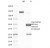 SDS-PAGE analysis of purified, BSA-free Epstein-Barr Virus antibody (clone CS1) as confirmation of integrity and purity.