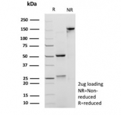 SDS-PAGE analysis of purified, BSA-free recombinant Annexin A1 antibody (clone ANXA1/3869R) as confirmation of integrity and purity.