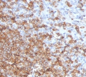 CD105 Antibody Human Tonsil Tissue IHC. Immunohistochemistry staining of FFPE human tonsil with CD105 antibody (clone CDLA105-1). HIER: boil tissue sections in pH 9 10mM Tris with 1mM EDTA for 10-20 min and allow to cool before testing.