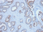 IHC staining of FFPE human prostate with Pan Cytokeratin antibody (clone PCK/3150). HIER: boil tissue sections in pH 9 10mM Tris with 1mM EDTA for 20 min and allow to cool before testing.