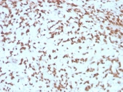 CTSD Antibody Liver IHC. Immunohistochemistry analysis of FFPE human liver with CTSD antibody (clone CTSD/3275). HIER: boil tissue sections in pH 9 10mM Tris with 1mM EDTA for 10-20 min and allow to cool before testing.
