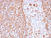 Vimentin Antibody / Cell Adhesion Marker Antibody for IHC. Immunohistochemistry analysis of FFPE human tonsil tissue using Vimentin antibody. The rabbit monoclonal clone VIM/1937R shows strong HRP-DAB brown cytoplasmic staining in stromal cells and supporting tissue architecture, with minimal staining in lymphoid cell populations. The staining pattern highlights interconnected stromal networks and cell-matrix interfaces, consistent with cytoskeletal anchoring and adhesion-associated structures. This distribution reinforces the use of Vimentin as a cell adhesion marker for identifying mesenchymal stromal compartments and structural support elements within lymphoid tissue.
