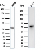 Vimentin Antibody / Cell Adhesion Marker Antibody WB. Western blot analysis of human A375 and U-87 cell lysates using Vimentin antibody. The rabbit monoclonal clone VIM/1937R detects a prominent band at approximately 55 kDa, consistent with the predicted molecular weight of Vimentin (VIM). The presence of a clear, single band across both cell lines supports detection of cytoskeletal components associated with adhesion-linked structural integrity. This banding pattern aligns with the role of Vimentin in anchoring intermediate filaments to adhesion complexes and reinforces its use as a cell adhesion marker in mesenchymal and tumor-derived cells.