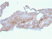 FN1 Antibody Human Lung IHC. Immunohistochemistry analysis of FFPE human lung tissue stained with clone FN1/2948. Extracellular and stromal HRP-DAB brown staining is observed throughout connective tissue and alveolar-associated matrix regions, consistent with expression of Fibronectin 1 / FN1 within extracellular matrix remodeling and tissue organization pathways. Clone FN1/2948 is supported by HuProt(TM) protein microarray specificity validation demonstrating highly selective recognition of FN1 in complex protein environments. HIER: boil tissue sections in pH 9 10mM Tris with 1mM EDTA for 20 min and allow to cool before testing.