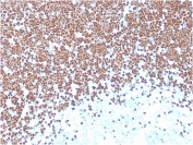 TdT Antibody Thymus IHC. Immunohistochemistry of TdT antibody in human thymus tissue. Formalin-fixed, paraffin-embedded human thymus demonstrates strong nuclear staining in immature cortical thymocytes, consistent with Terminal deoxynucleotidyl transferase expression in developing T lymphoblasts. Heat-induced epitope retrieval was performed by boiling tissue sections in pH 9 10mM Tris with 1mM EDTA for 20 minutes followed by cooling prior to staining. The microarray-validated monoclonal antibody clone TDT/1393 was used as the primary antibody, showing distinct nuclear localization in thymic precursor cells.