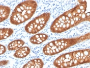 Villin Antibody. Immunohistochemistry analysis of Villin-1 (VIL1) in FFPE human colon using Villin Antibody / Actin-Binding Cytoskeletal Protein Antibody with recombinant rabbit monoclonal clone VIL1/4107R. Strong HRP-DAB brown staining is observed in the apical cytoplasm and membrane of colonic epithelial cells, outlining glandular structures with prominent luminal accentuation. The staining highlights actin-rich regions at the apical surface, consistent with Villin function as an actin-binding cytoskeletal protein involved in filament organization and remodeling within epithelial cells.