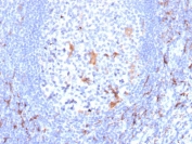 IHC staining of FFPE human tonsil with CD163 antibody (clone M130/2163). HIER: boil tissue sections in pH 9 10mM Tris with 1mM EDTA for 20 min and allow to cool before testing.