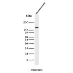 ITGB1 Antibody ITGB1/3613 Western Blot of Human Kidney. Western blot testing of human kidney tissue lysate with ITGB1 antibody clone ITGB1/3613. A strong predominant band is detected at approximately 130 kDa, above the approximately 88 kDa calculated molecular weight of the ITGB1 polypeptide. This higher apparent molecular weight is consistent with extensive glycosylation of mature integrin beta 1. The result demonstrates detection of mature CD29 protein by this CD29 Monoclonal Antibody.