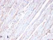 CDH2 Antibody Heart Tissue IHC. Immunohistochemical analysis of N-Cadherin / CDH2 expression in formalin-fixed, paraffin-embedded human heart tissue using CDH2 antibody. Membranous and cytoplasmic staining is observed in cardiomyocytes, with signal accentuated along cell-cell junctions consistent with localization at intercalated discs. The staining highlights elongated cardiac muscle fibers with expected structural organization, while surrounding stromal areas show minimal background. HIER: boil tissue sections in pH 9 10mM Tris with 1mM EDTA for 20 min and allow to cool before testing.
