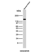 CDH2 Antibody Tissue WB. Western blot analysis of N-Cadherin / CDH2 expression in human heart tissue lysate using CDH2 antibody clone CDH2/3874R. Lane 1: human heart lysate. A strong band is detected at approximately 120-135 kDa, consistent with the predicted molecular weight of N-Cadherin (CDH2), with the higher apparent migration reflecting known glycosylation of this transmembrane adhesion protein. The prominent signal in heart tissue is consistent with the essential role of N-Cadherin in maintaining cardiomyocyte adhesion and intercalated disc integrity.