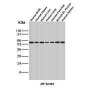 AKT1 Antibody Multi-Tissue WB. Western blot analysis of human brain, kidney, liver, lung, pancreas, skeletal muscle, and spleen tissue lysates using AKT1 antibody (clone AKT1/3898R) detects a band at approximately 55-60 kDa, consistent with the predicted molecular weight of AKT1, with uniform expression observed across tissues.