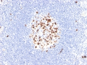 TOP2A Antibody / Topoisomerase II Alpha Antibody (clone TOP2A/4397R). Immunohistochemistry analysis of FFPE human lymph node tissue demonstrates nuclear staining consistent with expression of the Topoisomerase II alpha protein in proliferating lymphoid cells. Nuclear immunoreactivity is concentrated within germinal center lymphocytes, reflecting the known association of Topoisomerase II alpha with actively dividing cells undergoing DNA replication and mitosis. The Topoisomerase II Alpha Antibody highlights proliferative lymphoid populations within the germinal center while surrounding resting lymphocytes show minimal staining. Antigen retrieval was performed by boiling tissue sections in pH 9 Tris-EDTA buffer prior to immunohistochemistry staining.