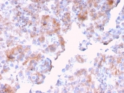 SERBP1 Antibody Human Kidney Tissue IHC. Immunohistochemistry staining of FFPE human kidney with SERBP1 antibody. HIER: boil tissue sections in pH 9 10mM Tris with 1mM EDTA for 20 min and allow to cool before testing.