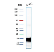 FTL Antibody A431 WB. Western blot analysis of A431 cell lysate using FTL Antibody detects a strong band at approximately 20 kDa, consistent with ferritin light chain / FTL. The observed signal supports expression of this intracellular iron storage protein involved in iron sequestration, oxidative stress regulation, and ferritin complex-mediated cellular iron homeostasis pathways.