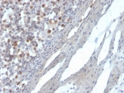 RAD51 Antibody Human Kidney IHC. Immunohistochemical staining of FFPE human kidney demonstrates RAD51 expression using a RAD51 antibody. RAD51, also known as a Homologous Recombination Protein, is a central mediator of DNA double strand break repair and maintenance of genomic stability. Nuclear staining is observed in renal cells, consistent with the requirement for efficient homologous recombination and DNA damage responses in highly metabolically active tissues. Heat induced epitope retrieval was performed by boiling tissue sections in pH 9 10 mM Tris buffer containing 1 mM EDTA for 20 minutes followed by cooling prior to staining. These results support the utility of RAD51 Antibody for investigating genome maintenance, DNA repair pathways, and cellular responses to genotoxic stress.
