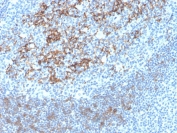 Immunohistochemistry of CD23 Antibody in human tonsil. FFPE human tonsil tissue was stained with recombinant CD23 antibody FCER2/4395R. Distinct membranous and focal cytoplasmic HRP-DAB brown staining is observed in B lymphocytes within germinal centers and mantle zones, consistent with known CD23 expression on mature follicular B cells. Surrounding T cell rich areas show minimal staining, supporting cell type specificity. Heat induced epitope retrieval was performed by boiling tissue sections in pH 9 Tris-EDTA buffer for 20 minutes followed by cooling prior to antibody incubation.